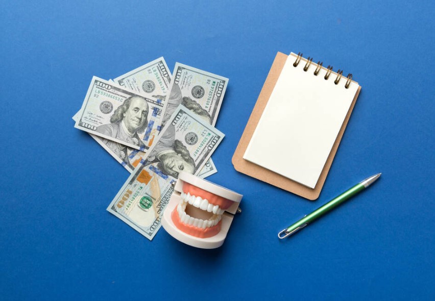 dental implant costs